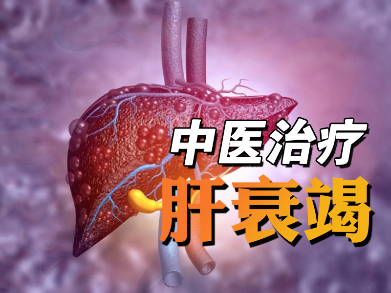 中医治疗肝衰竭