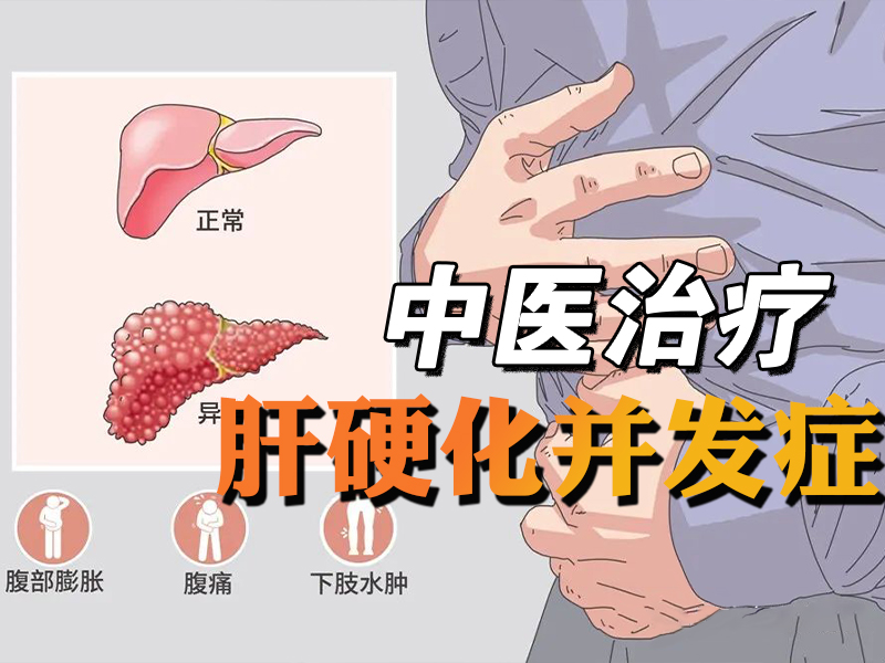 肝硬化并发症治疗